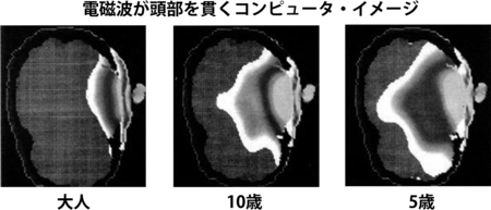 電磁波が頭部を貫くコンピュータイメージ。大人よりも子供の頭を深く貫いている。