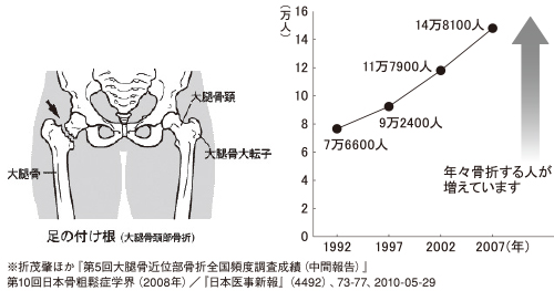 足の付け根の骨の骨折　年間推計発生患者数の推移